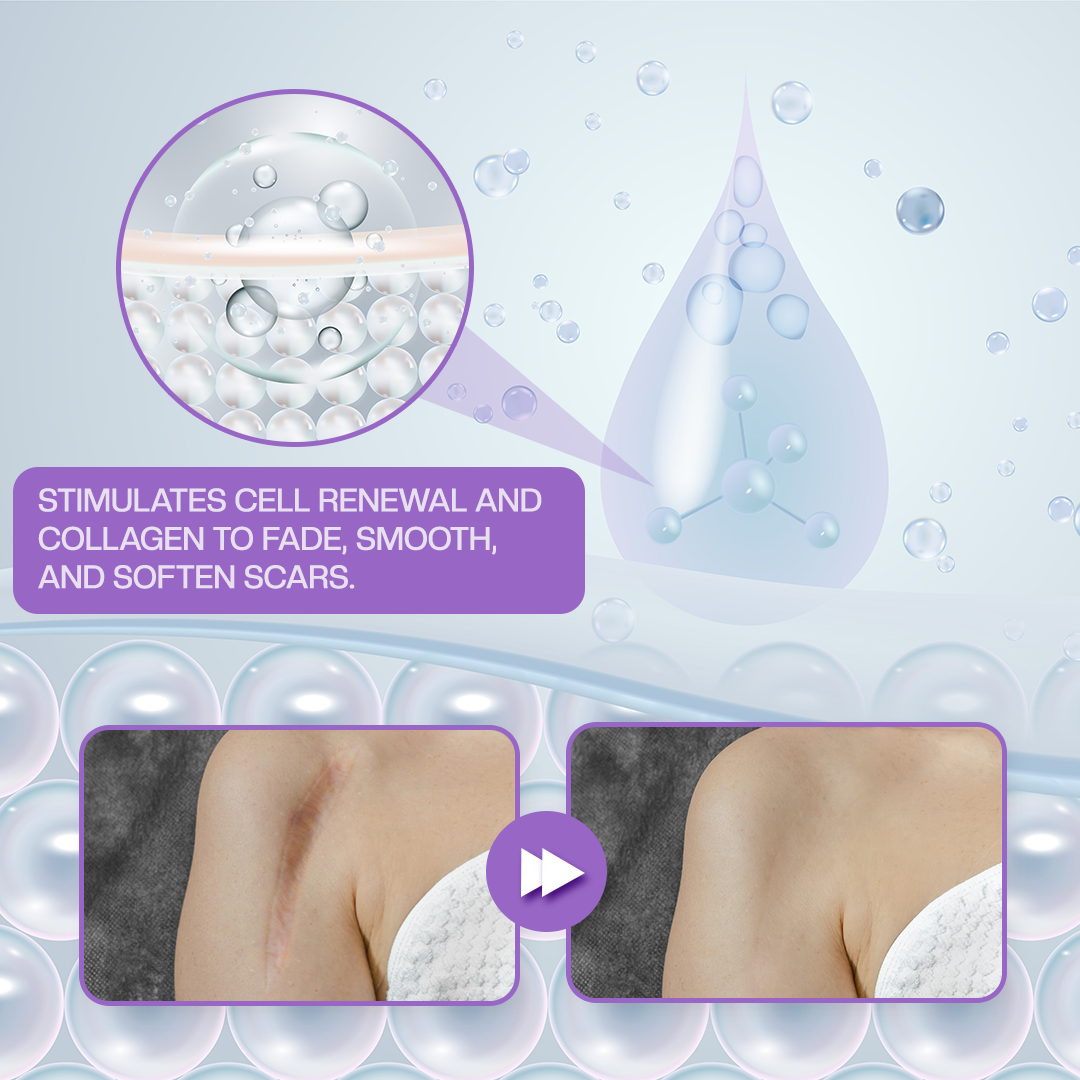 LOVILDS® RevivaDerma Face & Body Scar Gel - Clinically proven to soften, flatten and fade surgical scars, acne marks, burns, keloids and trauma-related scars 🎁