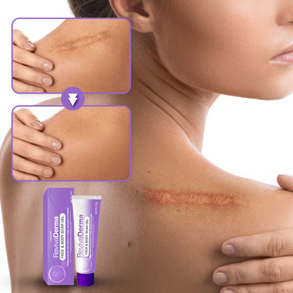 LOVILDS® RevivaDerma Face & Body Scar Gel - Clinically proven to soften, flatten and fade surgical scars, acne marks, burns, keloids and trauma-related scars 💥